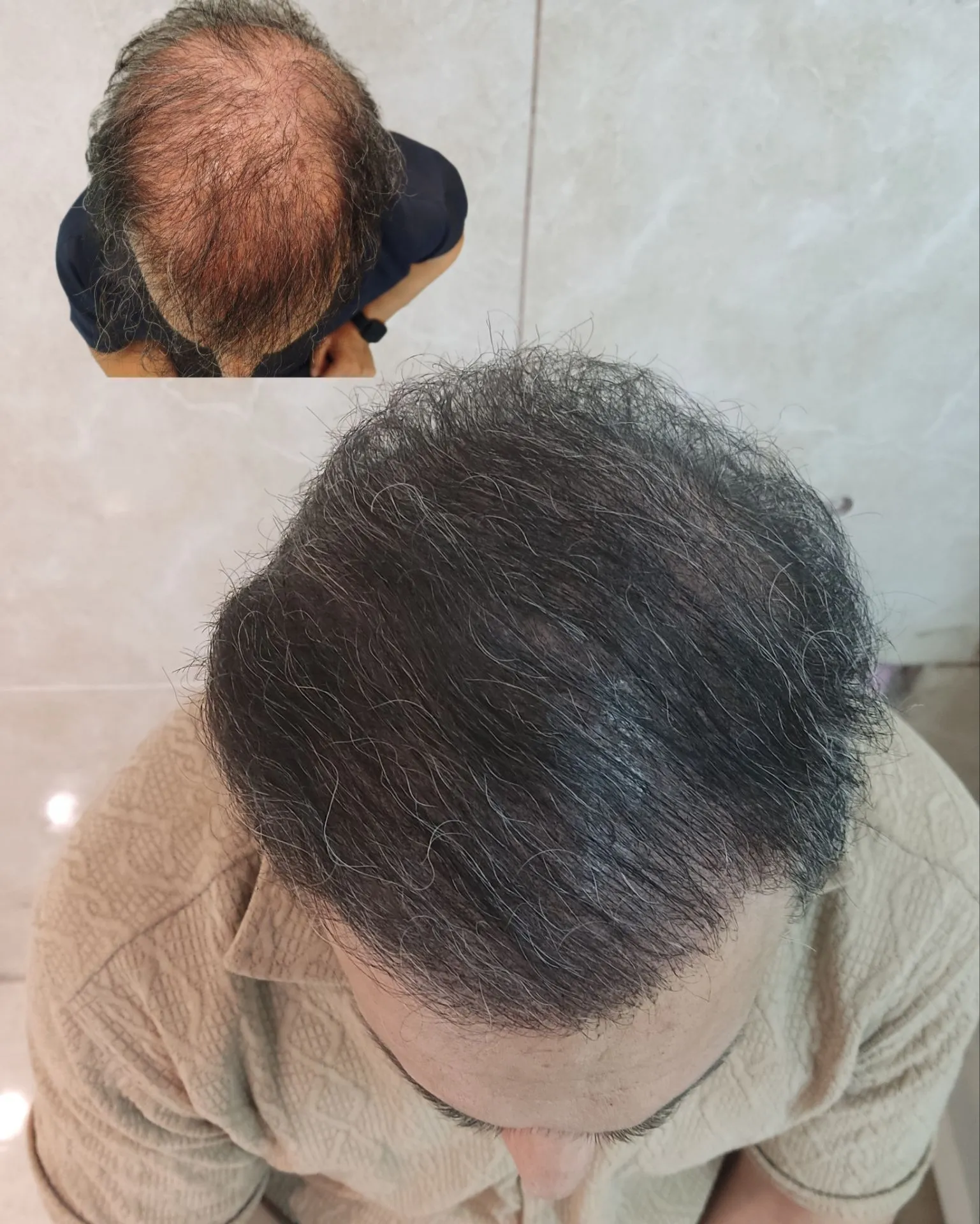 نمونه میکرواسکالپ